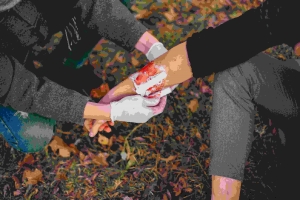 What Are the Symptoms of a Macerated Wound? 