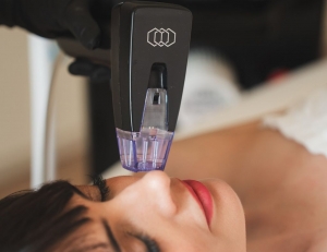 Morpheus8 Treatment for Tight, Radiant, and Youthful Looking Skin