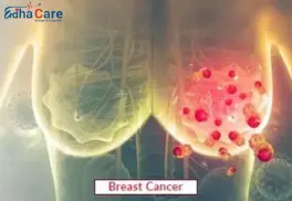 Comprehensive Guide to Breast Cancer Treatment in India: Procedures, Cost & Care