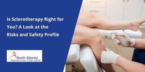Is Sclerotherapy Right for You? A Look at the Risks and Safety Profile