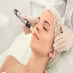 What to Expect During a Professional Derma Roller Session
