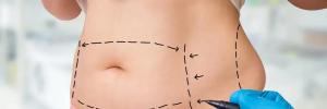 How Does Bariatric Surgery in Dubai Affect Mental Health and Emotional Well-being
