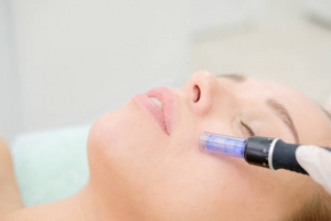 Say Goodbye to Scars with Derma Pen