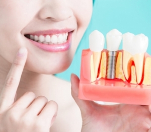 Grab the dental implants Hawthorn and get peaceful smile