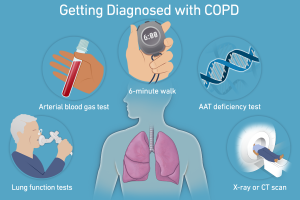 Chronic Obstructive Pulmonary Disease Diagnosis Market to Grow Owing to Spirometry Advances