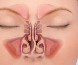 Vasomotor Symptoms Market Growth Driven by Hormone-Free Therapies