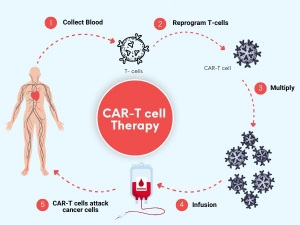 CAR T-Cell Therapy in India: Revolutionizing Blood Cancer Treatment