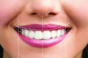 From Consultation to Completion: A Patient’s Journey with Digital Smile Design