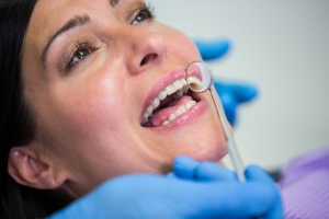 Enhance Your Smile with Dental Implants in La Jolla: A Permanent Solution for Missing Teeth
