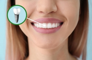 Dental Implants Give You the Freedom to Eat and Smile Confidently