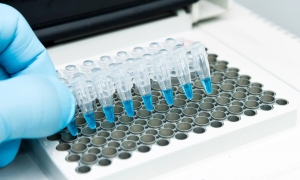 Minimal Residual Disease Testing Market to Surge with Next-Generation Sequencing