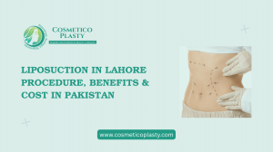 Liposuction in Lahore – Procedure, Benefits & Liposuction Cost in Pakistan
