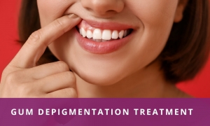 Top Techniques for Gum Depigmentation in 2025