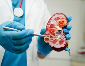 The Best Urology Surgeon in Kota: Dr. Jayesh Mittal's Proven Expertise