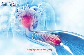 Angioplasty in India: Advanced Heart Care at Affordable Costs