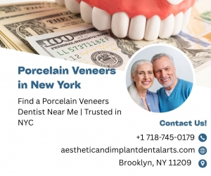 The Top Benefits of Porcelain Veneers