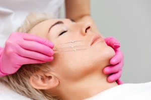 Can Thread Lift Be Combined with Other Cosmetic Treatments?