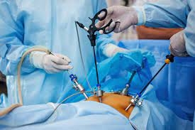 What is Laparoscopic Surgery?