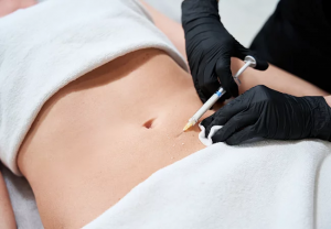 Fat Melting Injections for a Sleek and Sexy Silhouette