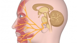 Acoustic Neuroma Market to Grow via Advanced Radiation Techniques