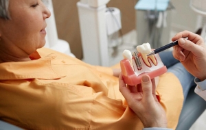 Who Is a Good Candidate for Same-Day Dental Implants?