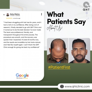 Leading Hair Transplant Solution for Men in India – QHT Clinic