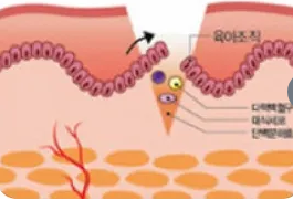 Boost Your Brand With High-Quality, Custom OEM Hydrocolloid Patches: Learn How