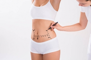 Obesity Surgery in Riyadh: FAQs Answered