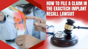 How to File a Claim in the Exactech Implant Recall Lawsuit