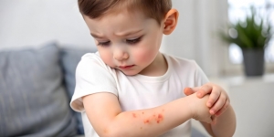 Calamine Lotion for Kids: A Gentle Solution for Itchy Skin and Rashes