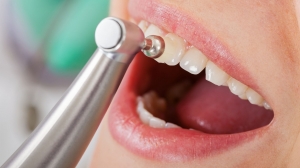 What People Get Wrong About Dental Prices in Dubai