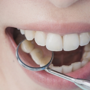 Ease Dental Anxiety with Safe and Effective Nitrous Oxide Sedation
