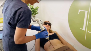 Can Laser Really Remove Scars? Everything You Need to Know