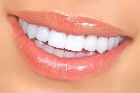 Can Composite Veneers Stain Like Natural Teeth?