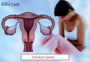 Cervical Cancer Treatment in India: Procedures, Cost & Why India is the Best Destination