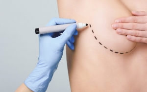 FDA-Approved Breast Implants Available in Islamabad