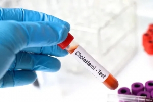 Cholesterol Testing Services Market to Surge via Point of Care Diagnostics