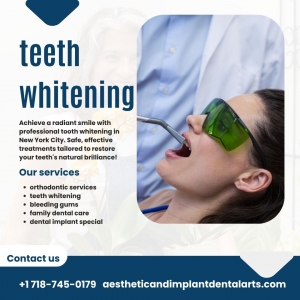How long will my teeth whitening results last?