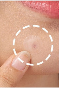 For Brands & Businesses: Partner With A Leading Hydrocolloid Patch Manufacturer