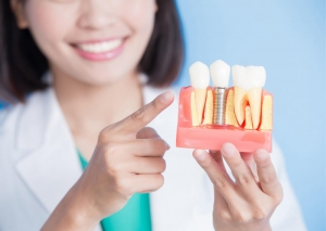 The benefits of dental implants in Birmingham for patients with dental anxiety