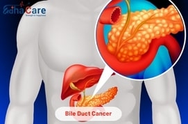 Advanced and Affordable Bile Duct Cancer Treatment in India: A Life-Saving Opportunity