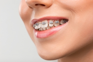 Your Smile Journey Starts in Dubai