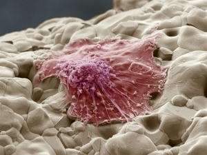 Human Osteoblasts Market Booms by Regenerative Medicine Adoption