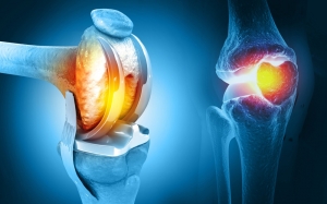 Restore Comfort and Confidence with Joint Replacement at Lokmanya Hospital
