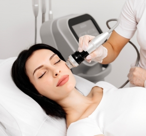 Why Fractional RF Microneedling Is Ideal for Skin Renewal