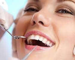What to Expect During a Routine Dental Exam?