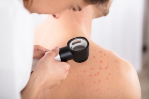 Unveiling Your Best Skin: Choosing the Right Dermatologist for Laser Treatments