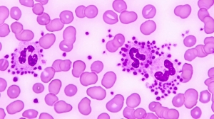 Immunotherapy Advances Drive Immune Thrombocytopenia Treatment Market Growth