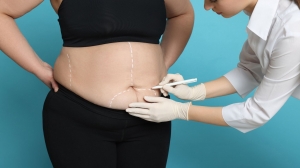 Can I Have Bariatric Surgery in Dubai If I’ve Already Had Abdominal Surgery?