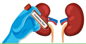 Ayurvedic Treatment for Kidney Creatinine: Natural Ways to Lower High Creatinine Levels